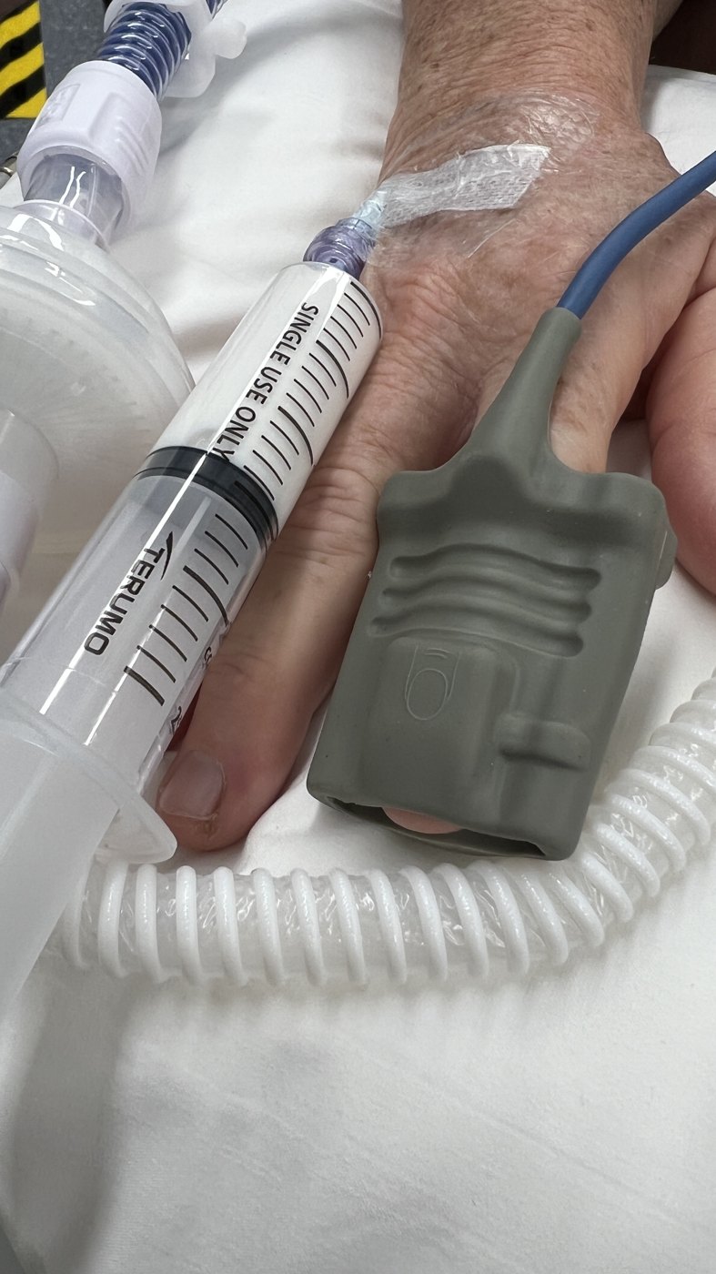 Finger pulse oximeter probe near respiratory circuit tubing.